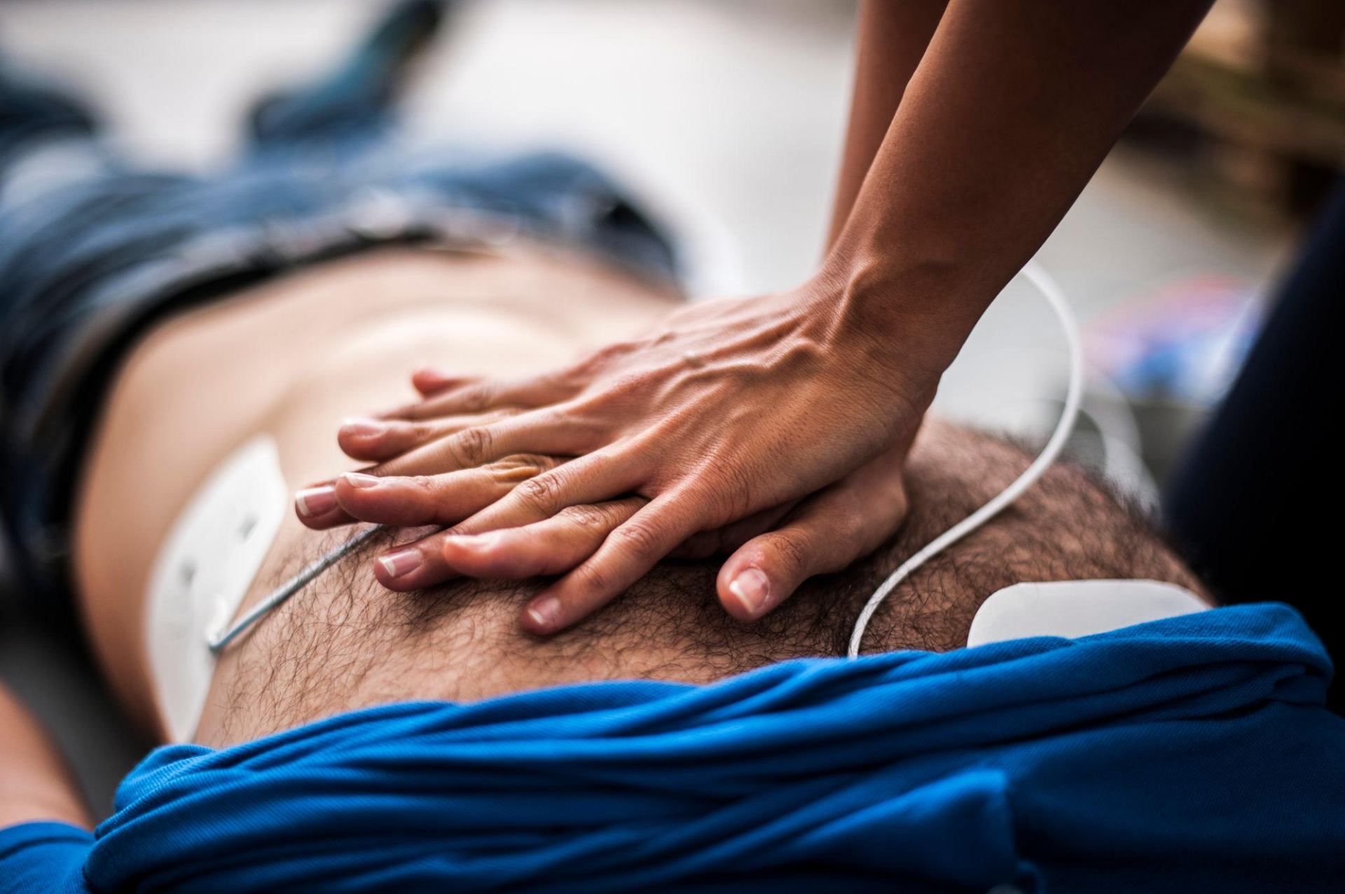CPR being performed with AED pads attached
